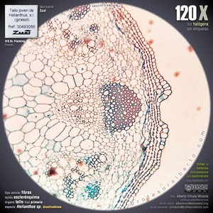 Esclerénquima: Fibras